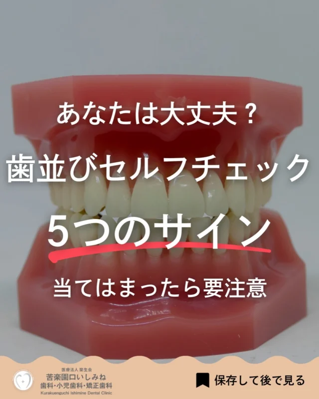 こんばんは🌇
苦楽園口いしみね歯科・小児歯科・矯正歯科です🦷

歯並びが乱れている人には 口元にサインが出ていることがあります。

歯並びは見た目だけでなく 歯磨きのしにくさや 虫歯・歯周病、口呼吸などに 関係することもあります🦷

今回の投稿では 歯並びに関係することがある 5つのサインをまとめました。
当てはまる項目はありましたか？

気になる方は 後で見返せるように 保存しておくのもおすすめです。

✼••┈┈┈┈┈┈┈┈┈┈┈┈┈┈┈┈••✼
苦楽園口いしみね歯科・小児歯科・矯正歯科

📍苦楽園口駅徒歩1分
100台分の駐車スペースあり
〒662-0075 兵庫県西宮市南越木岩町10-7

⏰平日9:30から13:00/14:30から19:00
土日9:00から13:00/14:00から18:00
※木曜、祝日休診

🩺診察科目：一般歯科・小児歯科・矯正歯科・口腔外科
✼••┈┈┈┈┈┈┈┈┈┈┈┈┈┈┈┈••✼

#西宮矯正歯科 西宮歯科 #苦楽園口 #夙川 甲子園口　芦屋
歯並び改善 歯並び気になる #マウスピース矯正 インビザライン
小児矯正 ワイヤー矯正 矯正相談 出っ歯 受け口 反対咬合
こども矯正 歯科矯正 矯正歯科 ホワイトニング西宮 西宮ママ 歯医者さん選び #西宮歯医者