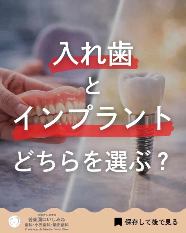 こんばんは🌇
苦楽園口いしみね歯科・小児歯科・矯正歯科です🦷

入れ歯とインプラント、どちらが良いか迷う方も多いのではないでしょうか
それぞれに特徴があり 費用・見た目・噛みやすさ・治療方法などに違いがあります

入れ歯は 比較的手軽に始めやすく 費用を抑えられる場合があります💰

一方、インプラントは 顎の骨に固定することで しっかり噛める・見た目が自然といった特徴があります🦷

ただし、どちらが適しているかは お口の状態や全身の健康状態によって異なります
それぞれの特徴を理解したうえで ご自身に合った方法を選ぶことが大切です

気になる方は お気軽にご相談ください🏥

✼••┈┈┈┈┈┈┈┈┈┈┈┈┈┈┈┈••✼
苦楽園口いしみね歯科・小児歯科・矯正歯科

📍苦楽園口駅徒歩1分
100台分の駐車スペースあり
〒662-0075 兵庫県西宮市南越木岩町10-7

⏰平日9:30から13:00/14:30から19:00
土日9:00から13:00/14:00から18:00
※木曜、祝日休診

🩺診察科目：一般歯科・小児歯科・矯正歯科・口腔外科
✼••┈┈┈┈┈┈┈┈┈┈┈┈┈┈┈┈••✼

#西宮矯正歯科 #西宮歯科 #苦楽園口 #夙川 #西宮北口芦屋
歯並び改善 歯並び気になる マウスピース矯正インビザライン
小児矯正 ワイヤー矯正 矯正相談 出っ歯 受け口 反対咬合
こども矯正 歯科矯正 矯正歯科 ホワイトニング西宮 西宮ママ 歯医者さん選び