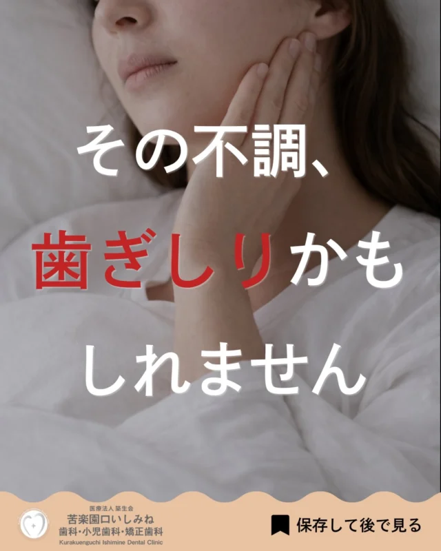 こんばんは🌇
苦楽園口いしみね歯科・小児歯科・矯正歯科です🦷

朝起きても疲れが取れない😣 顎がだるい・重たい💭
そんな不調、 歯ぎしり・食いしばりが関係しているかもしれません。
歯ぎしりは寝ている間だけでなく、 日中の無意識の食いしばりとして起こることもあります。
気づかないまま続くと、 歯がすり減る・ヒビが入る・しみる 顎まわりの違和感やエラ張りにつながることもあります⚠️
「もしかして当てはまるかも」と思った方は、 早めのチェックがおすすめです🦷
気になる症状がある方は お気軽にご相談ください。

✼••┈┈┈┈┈┈┈┈┈┈┈┈┈┈┈┈••✼
苦楽園口いしみね歯科・小児歯科・矯正歯科

HP🔍: https://kurakuenguchi-ishiminedental.com/

📍苦楽園口駅徒歩1分
100台分の駐車スペースあり
〒662-0075 兵庫県西宮市南越木岩町10-7

⏰平日9:30から13:00/14:30から19:00
土日9:00から13:00/14:00から18:00
※木曜、祝日休診

🩺診察科目：一般歯科・小児歯科・矯正歯科・口腔外科
✼••┈┈┈┈┈┈┈┈┈┈┈┈┈┈┈┈••✼

#西宮矯正歯科 #西宮歯科 #苦楽園口 #夙川 #西宮北口芦屋
歯ぎしり　食いしばり　顎の違和感
歯並び改善 歯並び気になる マウスピース矯正インビザライン
小児矯正 ワイヤー矯正 矯正相談 出っ歯 受け口 反対咬合
こども矯正 歯科矯正 矯正歯科 ホワイトニング西宮 西宮ママ 歯医者さん選び