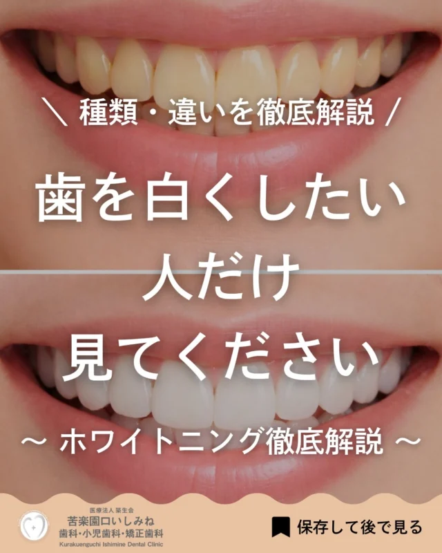 こんばんは🌆
苦楽園口いしみね歯科・小児歯科・矯正歯科です🦷

歯を白くしたいけど、 「どれを選べばいいのかわからない」 そんな方は多いと思います🦷

ホワイトニングには種類があり、 それぞれ効果の出方や持続期間、向いている方が異なります。

歯の表面の汚れを落とすだけではなく、 薬剤が歯の内部にまで作用し、 着色物質を分解することで歯の色そのものを明るくしていく治療です✨

「すぐに白くしたい」 「自然な白さにしたい」 「しっかり白さをキープしたい」
目的によって最適な方法は変わります。

当院では、 オフィス・ホーム・デュアル（パーフェクト）の3種類をご用意し、 患者さま一人ひとりに合わせてご提案しています😊

少しでも気になる方は、 お気軽にご相談ください📩

✼••┈┈┈┈┈┈┈┈┈┈┈┈┈┈┈┈••✼
苦楽園口いしみね歯科・小児歯科・矯正歯科

HP🔍: https://kurakuenguchi-ishiminedental.com/

📍苦楽園口駅徒歩1分
〒662-0075 兵庫県西宮市南越木岩町10-7

⏰平日9:30から13:00/14:30から19:00
土日9:00から13:00/14:00から18:00
※木曜、祝日休診

🩺診察科目：一般歯科・小児歯科・矯正歯科・口腔外科
✼••┈┈┈┈┈┈┈┈┈┈┈┈┈┈┈┈••✼
 #西宮歯科 #苦楽園口 #西宮北口
マウスピース矯正#インビザライン
小児矯正 ワイヤー矯正 矯正相談 出っ歯 受け口 反対咬合
こども矯正 歯科矯正 矯正歯科 #ホワイトニング西宮
小児矯正 ワイヤー矯正 矯正相談 出っ歯 受け口 反対咬合
こども矯正 歯科矯正 矯正歯科 ホワイトニング 西宮ママ 歯医者さん選び