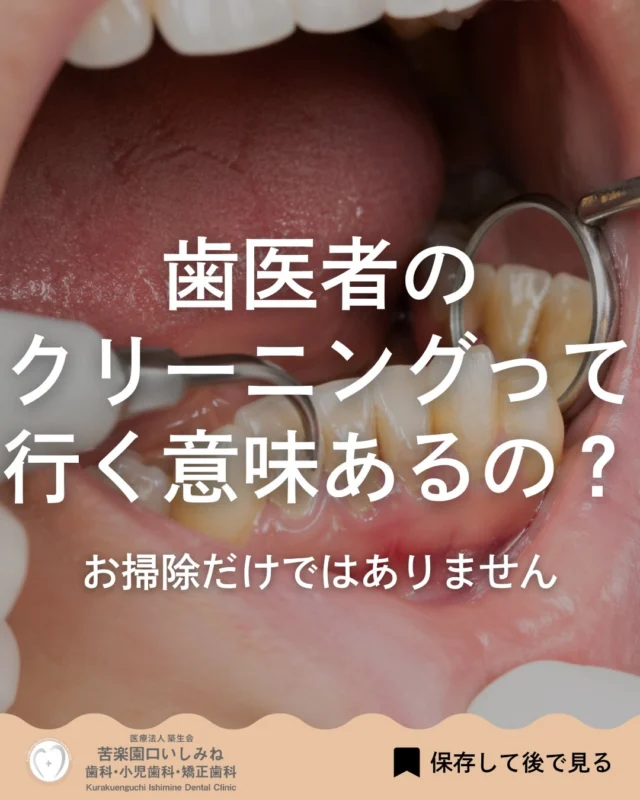 こんばんは🌇
苦楽園口いしみね歯科・小児歯科・矯正歯科です🦷

歯医者のクリーニングって、ただ歯をツルツルにするだけだと思っていませんか？🦷 実は、見えないところまでしっかりケアしている大事な治療なんです😊

歯ブラシでは落としきれない歯石を除去し、 歯ぐきの状態を整え、さらに歯周ポケットの中までケア🪥 これが歯周病や口臭の予防につながっていきます😌

クリーニング後は、歯ぐきの腫れが落ち着き、出血しにくくなり、 お口の中がすっきりした感覚に変わるのも特徴です🙂

そして何より大切なのは、 将来の歯を守ること🦷 定期的なケアを続けることで、歯の健康寿命は大きく変わります📈

「痛くなってから行く場所」ではなく、 「守るために通う場所」としての歯医者へ🏥
3〜6ヶ月に1回のクリーニング、ぜひ習慣にしてみてください📅

✼••┈┈┈┈┈┈┈┈┈┈┈┈┈┈┈┈••✼
苦楽園口いしみね歯科・小児歯科・矯正歯科

HP🔍: https://kurakuenguchi-ishiminedental.com/

📍苦楽園口駅徒歩1分
100台分の駐車スペースあり
〒662-0075 兵庫県西宮市南越木岩町10-7

⏰平日9:30から13:00/14:30から19:00
土日9:00から13:00/14:00から18:00
※木曜、祝日休診

🩺診察科目：一般歯科・小児歯科・矯正歯科・口腔外科
✼••┈┈┈┈┈┈┈┈┈┈┈┈┈┈┈┈••✼

#西宮矯正歯科  苦楽園口  #西宮北口　芦屋
#歯周病予防 口臭予防 #予防歯科 #歯石除去 歯医者さん 定期検診
歯並び改善 歯並び気になる マウスピース矯正インビザライン
小児矯正 ワイヤー矯正 矯正相談 出っ歯 受け口 反対咬合
こども矯正 歯科矯正 矯正歯科 ホワイトニング西宮 西宮ママ 歯医者さん選び