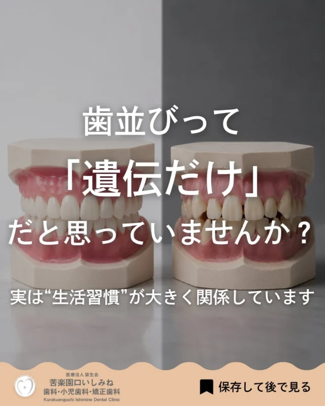 んばんは🌇
苦楽園口いしみね歯科・小児歯科・矯正歯科です🦷

「歯並びって遺伝だから仕方ない」 そう思っている方も多いですが、 実は“毎日のクセ”や“舌の位置”も 歯並びに大きく関係しています🦷
片側ばかりで噛む、 無意識の食いしばり、 口が開いたままの状態、 舌が下がっている…
こうした小さな習慣が積み重なることで、 少しずつ歯並びや噛み合わせが崩れていくことがあります。

「まだ大丈夫かな」 「矯正するほどでは…」 という段階でも大丈夫です◎
まずは今の状態を知ることが大切です😊

当院では、 現在の歯並びや噛み合わせの状態を確認し、 原因や今後の選択肢について 丁寧にご説明しています✨
気になる方は プロフィールのWEB予約より お気軽にご相談ください📩

✼••┈┈┈┈┈┈┈┈┈┈┈┈┈┈┈┈••✼
苦楽園口いしみね歯科・小児歯科・矯正歯科

HP🔍: https://kurakuenguchi-ishiminedental.com/

📍苦楽園口駅徒歩1分
100台分の駐車スペースあり
〒662-0075 兵庫県西宮市南越木岩町10-7

⏰平日9:30から13:00/14:30から19:00
土日9:00から13:00/14:00から18:00
※木曜、祝日休診

🩺診察科目：一般歯科・小児歯科・矯正歯科・口腔外科
✼••┈┈┈┈┈┈┈┈┈┈┈┈┈┈┈┈••✼

#西宮歯科 #苦楽園口#西宮北口
#歯並び改善 歯並び気になる #マウスピース矯正インビザライン
小児矯正 ワイヤー矯正 矯正相談 出っ歯 受け口 反対咬合
こども矯正 歯科矯正 矯正歯科 ホワイトニング西宮 西宮ママ 歯医者さん選び
