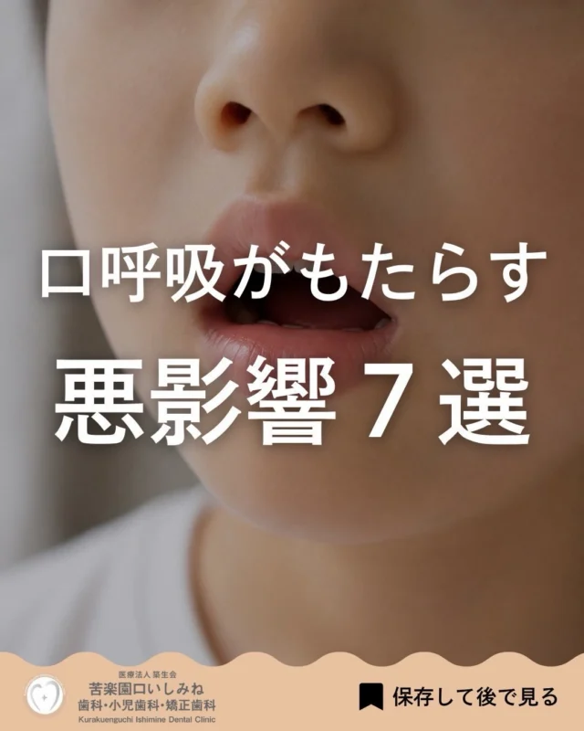 こんばんは🌇
苦楽園口いしみね歯科・小児歯科・矯正歯科です🦷

最近、無意識に「口ぽかん」になっていませんか？👄
実は口呼吸は、ただのクセと思っていても、お口の中や身体にさまざまな影響を与えていることがあります。

お口が乾燥しやすくなることで虫歯や口臭の原因につながったり、歯並びやフェイスライン、睡眠の質に影響することもあると言われています。

「朝起きたら口が乾いている」 「気づいたら口が開いている」 「いびきが気になる」 「口元が気になる」
そんな方は、もしかすると口呼吸が関係しているかもしれません🦷

毎日無意識にしていることだからこそ、早めに気づくことが大切です。
気になる症状がある方は、お気軽にご相談ください✨

✼••┈┈┈┈┈┈┈┈┈┈┈┈┈┈┈┈••✼
苦楽園口いしみね歯科・小児歯科・矯正歯科

HP🔍: https://kurakuenguchi-ishiminedental.com/

📍苦楽園口駅徒歩1分
100台分の駐車スペースあり
〒662-0075 兵庫県西宮市南越木岩町10-7

⏰平日9:30から13:00/14:30から19:00
土日9:00から13:00/14:00から18:00
※木曜、祝日休診

🩺診察科目：一般歯科・小児歯科・矯正歯科・口腔外科
✼••┈┈┈┈┈┈┈┈┈┈┈┈┈┈┈┈••✼
#西宮歯科 #苦楽園口
#口ぽかん#口臭#口臭ケア
歯並び改善 歯並び気になる マウスピース矯正インビザライン
小児矯正 ワイヤー矯正 矯正相談 出っ歯 受け口 反対咬合
こども矯正 歯科矯正 矯正歯科 ホワイトニング西宮 西宮ママ 歯医者さん選び
