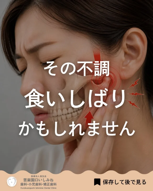 こんばんは🌇
苦楽園口いしみね歯科・小児歯科・矯正歯科です🦷

朝起きると顎が疲れていたり、肩こりや頭痛が続いていたり…😣
「なんとなく不調」がある方、もしかすると無意識の“食いしばり”が関係しているかもしれません🦷

食いしばりは、寝ている間や集中している時など、
自覚のないまま起こっていることが多くあります😴

強い力が繰り返しかかることで、
・歯のすり減り ・ヒビや欠け ・知覚過敏 ・詰め物が外れる ・顎や筋肉への負担
につながることもあります💭

「ただの疲れかな？」と思っていた不調が、実は噛み合わせや食いしばりによる負担だった…ということも少なくありません。
気づかないうちに進行していることもあるため、早めのチェックが大切です🔍✨
気になる症状がある方は、お気軽にご相談ください😊

✼••┈┈┈┈┈┈┈┈┈┈┈┈┈┈┈┈••✼
苦楽園口いしみね歯科・小児歯科・矯正歯科

HP🔍: https://kurakuenguchi-ishiminedental.com/

📍苦楽園口駅徒歩1分
100台分の駐車スペースあり
〒662-0075 兵庫県西宮市南越木岩町10-7

⏰平日9:30から13:00/14:30から19:00
土日9:00から13:00/14:00から18:00
※木曜、祝日休診

🩺診察科目：一般歯科・小児歯科・矯正歯科・口腔外科
✼••┈┈┈┈┈┈┈┈┈┈┈┈┈┈┈┈••✼
#西宮歯科 #苦楽園口
#歯ぎしり#食いしばり#顎の違和感
歯並び改善 歯並び気になる マウスピース矯正インビザライン
小児矯正 ワイヤー矯正 矯正相談 出っ歯 受け口 反対咬合
こども矯正 歯科矯正 矯正歯科 ホワイトニング西宮 西宮ママ 歯医者さん選び