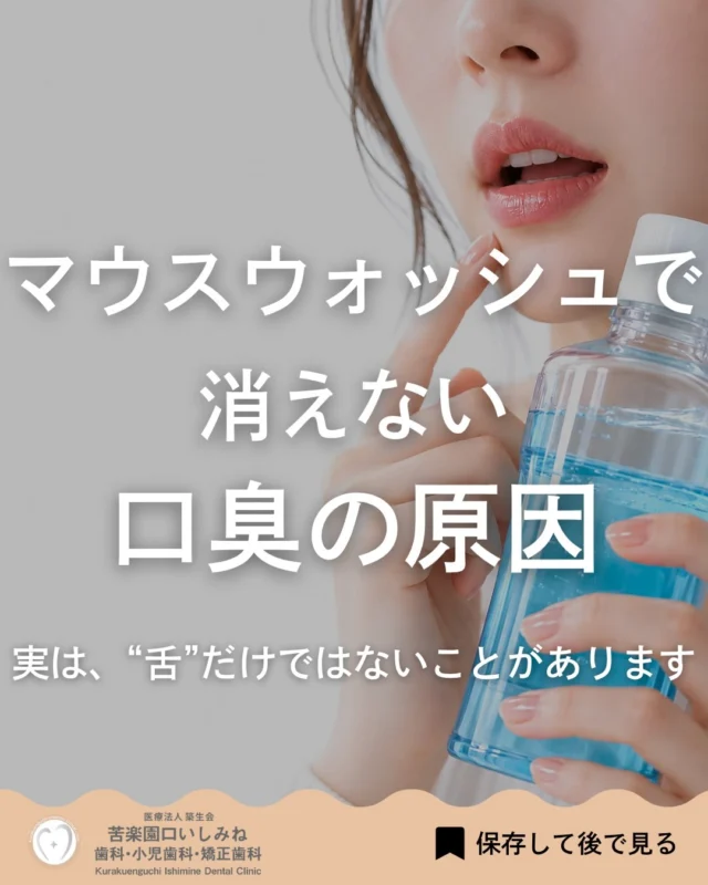 こんばんは🌇
苦楽園口いしみね歯科・小児歯科・矯正歯科です🦷

マウスウォッシュや舌磨きをしているのに、 「なんとなく口臭が気になる…」 そんな経験はありませんか？🦷

実は、口臭の原因は1つではありません。
舌の汚れだけではなく、
・歯ぐきの炎症 ・お口の乾燥 ・詰め物の段差 ・細菌の増殖 ・鼻や喉、全身的な原因

など、さまざまな原因が関係していることがあります。
見た目では分かりにくい場合もあるため、 当院ではお口の中を総合的にチェックし、 必要に応じて他科と連携することもあります

「口臭かも…？」 と気になった時は、 1人で悩まずお気軽にご相談ください☺️

✼••┈┈┈┈┈┈┈┈┈┈┈┈┈┈┈┈••✼
苦楽園口いしみね歯科・小児歯科・矯正歯科

HP🔍: https://kurakuenguchi-ishiminedental.com/

📍苦楽園口駅徒歩1分
100台分の駐車スペースあり
〒662-0075 兵庫県西宮市南越木岩町10-7

⏰平日9:30から13:00/14:30から19:00
土日9:00から13:00/14:00から18:00
※木曜、祝日休診

🩺診察科目：一般歯科・小児歯科・矯正歯科・口腔外科
✼••┈┈┈┈┈┈┈┈┈┈┈┈┈┈┈┈••✼
#西宮歯医者＃西宮小児歯科 #苦楽園口 
#口臭ケア #歯周病 #舌苔 歯科検診