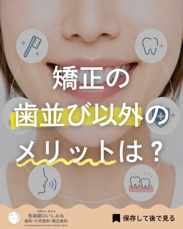 こんばんは🌇
苦楽園口いしみね歯科・小児歯科・矯正歯科です🦷

「歯並びが悪いと見た目の問題だけ」🦷
そう思われることも少なくありません。

実は歯並びや噛み合わせは、見た目だけでなくお口の健康にも大きく関係しています✨
歯が重なっている部分は歯ブラシやフロスが届きにくく、汚れが残りやすくなります。
その結果、虫歯や歯周病のリスクが高まることがあります⚠️

また、噛み合わせが悪い状態が続くと、一部の歯だけに強い力がかかり、
🔹歯が欠ける 🔹すり減る 🔹しみる
原因になることもあります。

さらに、歯並びや噛み合わせは発音や口元の印象にも影響する場合があります💬
矯正治療によって、お口の機能面が改善し、
毎日の生活がより快適になるケースも少なくありません😊

歯並びが気になる方や、お子さまの歯並びについて相談したい方は、
お気軽にご相談ください🦷🌿

✼••┈┈┈┈┈┈┈┈┈┈┈┈┈┈┈┈••✼
苦楽園口いしみね歯科・小児歯科・矯正歯科

HP🔍: https://kurakuenguchi-ishiminedental.com/

📍苦楽園口駅徒歩1分
100台分の駐車スペースあり
〒662-0075 兵庫県西宮市南越木岩町10-7

⏰平日9:30から13:00/14:30から19:00
土日9:00から13:00/14:00から18:00
※木曜、祝日休診

🩺診察科目：一般歯科・小児歯科・矯正歯科・口腔外科
✼••┈┈┈┈┈┈┈┈┈┈┈┈┈┈┈┈••✼
#矯正歯科 #歯列矯正 #小児矯正 #歯並び改善 #苦楽園口いしみね歯科小児歯科矯正歯科