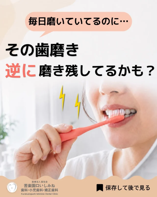 こんばんは🌇
苦楽園口いしみね歯科・小児歯科・矯正歯科です🦷

毎日歯を磨いているのに、
むし歯や歯ぐきの腫れを指摘されたことはありませんか？🧑‍⚕️

特に注意したいのが、
汚れを落とそうとして力を入れすぎてしまうこと。

ゴシゴシ磨くときれいになりそうですが、
毛先が広がって必要な場所に届きにくくなり、
歯ぐきを傷つけてしまうこともあります。

大切なのは、強く磨くことではなく、
毛先を汚れが残りやすい場所へ丁寧に当てることです✨

歯ブラシの交換は約1か月が目安です。
1か月以内でも、後ろから見て毛先がヘッドからはみ出していたら交換しましょう🪥

当院では、お口の状態に合わせた歯ブラシの当て方や、ケア用品の選び方もお伝えしています。定期検診の際にお気軽にご相談ください😊
あとで見直せるよう、ぜひ保存してお役立てください。

✼••┈┈┈┈┈┈┈┈┈┈┈┈┈┈┈┈••✼
苦楽園口いしみね歯科・小児歯科・矯正歯科

HP🔍: https://kurakuenguchi-ishiminedental.com/

📍苦楽園口駅徒歩1分
100台分の駐車スペースあり
〒662-0075 兵庫県西宮市南越木岩町10-7

⏰平日9:30から13:00/14:30から19:00
土日9:00から13:00/14:00から18:00
※木曜、祝日休診

🩺診察科目：一般歯科・小児歯科・矯正歯科・口腔外科
✼••┈┈┈┈┈┈┈┈┈┈┈┈┈┈┈┈••✼
#苦楽園口いしみね歯科 #西宮歯医者 #歯磨き #予防歯科 #歯科定期検診